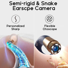Load image into Gallery viewer, Bebird EarSight Plus Ear Wax Removal
