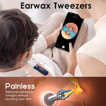 Load image into Gallery viewer, Bebird EarSight Plus Ear Wax Removal
